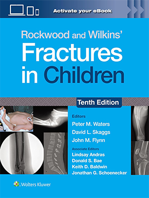 Rockwood and Wilkins’ Fractures in Children