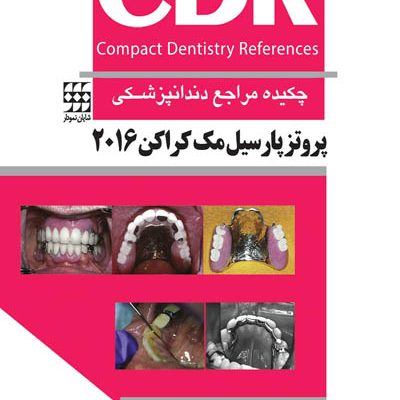 CDR پروتز پارسیل مک کراکن 2016 (چکیده مراجع دندانپزشکی)