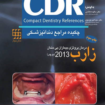 CDR درمان پروتزی بیماران بی دندان زارب (بوچر) ۲۰۱۳ (چکیده مراجع دندانپزشکی)