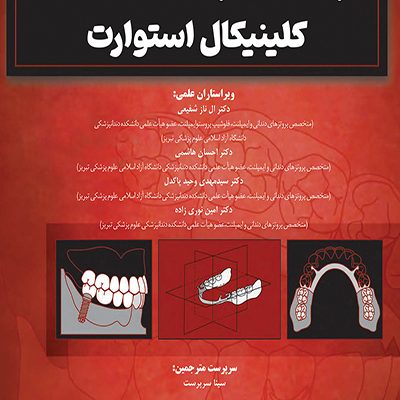 پروتزهای پارسیل متحرک کلینیکال استوارت